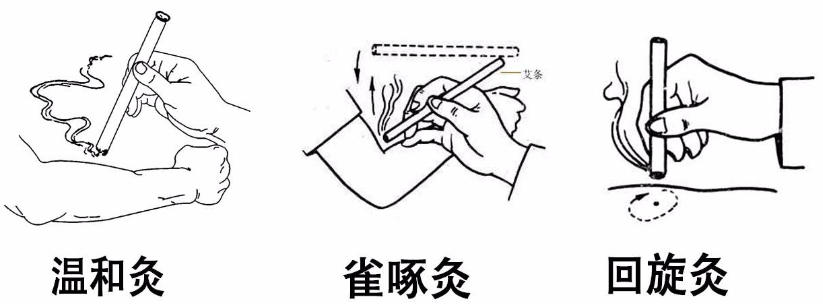 灸法之施灸方法分类