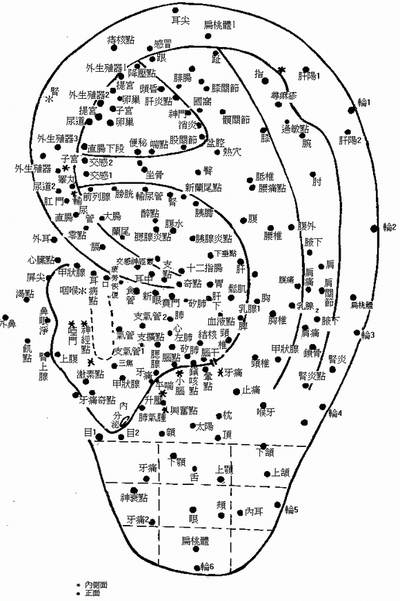 耳穴图
