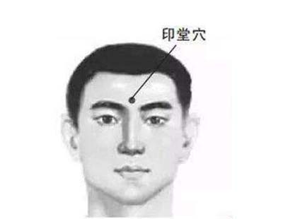 印堂穴