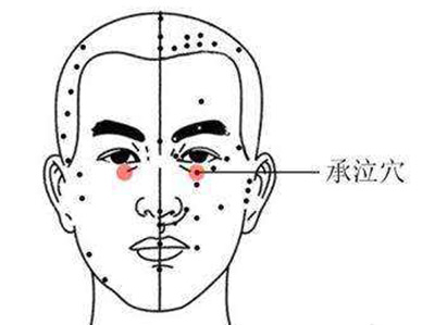 承泣穴