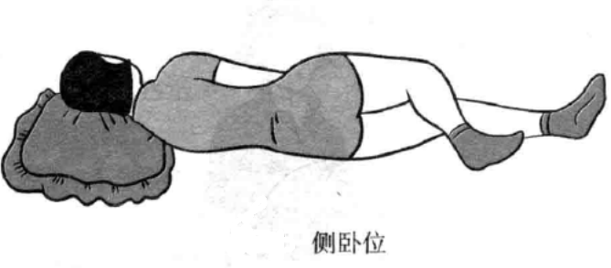 侧卧位
