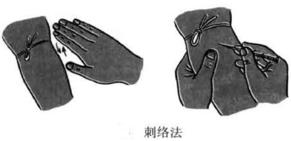 刺络法
