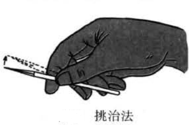 挑治法