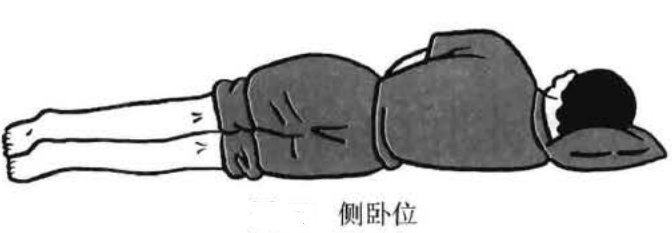 侧卧位