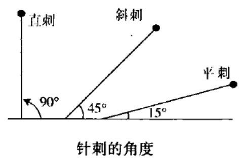 针刺的角度